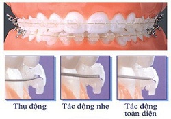 Lug jaw bone and treatment
